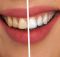 tooth-2414909_1280