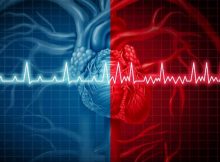 Cos'è l'aritmia cardiaca