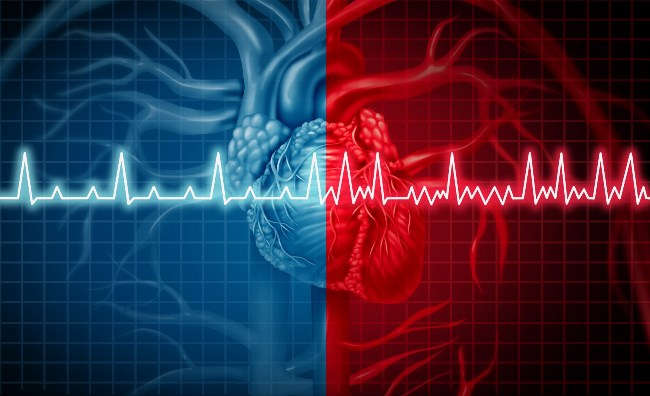 Cos'è l'aritmia cardiaca